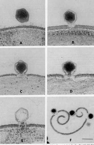Illustration for article titled Descubren un virus de las algas que afecta al cerebro humano